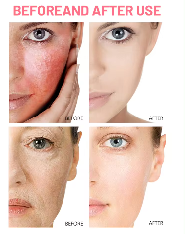 SERUM DE ROSAS CON ACIDO HIALURONICO